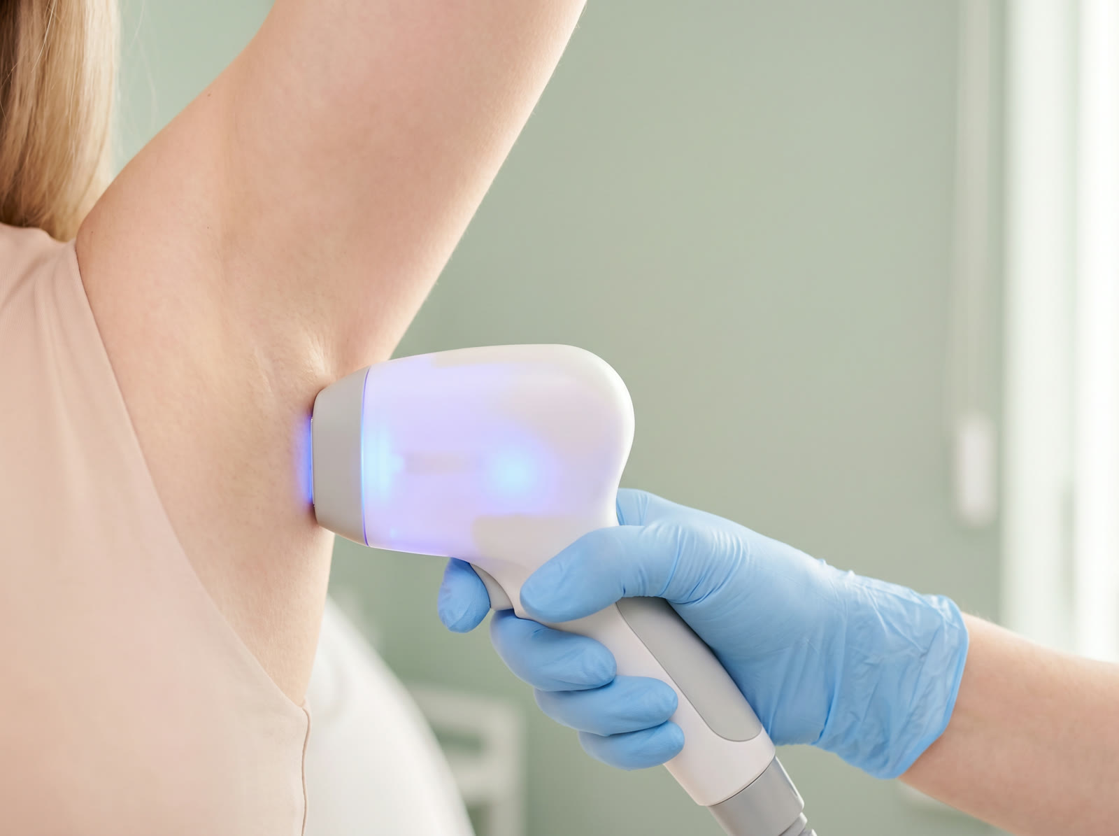 Laser hair removal treatment on the underarm at Glowe Aesthetics, Wellington